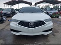 2020 Acura TLX — photo 13 of 20 | VIN 19UUB1F33LA005227