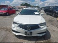 2018 Acura TLX — photo 12 of 16 | VIN 19UUB1F35JA006277