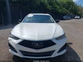 2022 Acura TLX — photo 6 of 16 | VIN 19UUB5F44NA005661