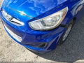 2013 Hyundai Accent — photo 6 of 17 | VIN KMHCT4AEXDU554677