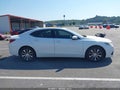 2015 Acura TLX — photo 14 of 17 | VIN 19UUB1F33FA027359