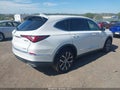 2022 Acura MDX — photo 4 of 16 | VIN 5J8YE1H40NL037932