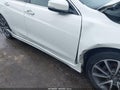 2015 Acura TLX — photo 12 of 22 | VIN 19UUB2F50FA023017