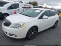 2016 Buick Verano — photo 2 of 16 | VIN 1G4PW5SK5G4185038