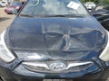 2014 Hyundai Accent — photo 10 of 11 | VIN KMHCU5AE6EU145905