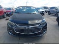 2017 Chevrolet Malibu — photo 12 of 16 | VIN 1G1ZE5ST8HF178396