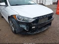 2017 Hyundai Elantra — photo 6 of 17 | VIN 5NPD84LFXHH146762