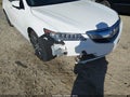 2017 Acura TLX — photo 6 of 16 | VIN 19UUB1F38HA002167