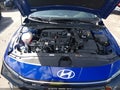 2025 Hyundai Elantra — photo 10 of 16 | VIN KMHLR4DF3SU055977