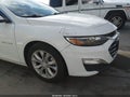 2024 Chevrolet Malibu — photo 20 of 20 | VIN 1G1ZD5ST5RF174438