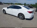 2017 Acura TLX — photo 3 of 15 | VIN 19UUB1F35HA003485