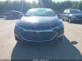 2023 Chevrolet Malibu — photo 12 of 16 | VIN 1G1ZD5ST8PF116708