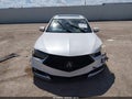 2020 Acura TLX — photo 11 of 20 | VIN 19UUB1F63LA000006