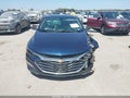 2022 Chevrolet Malibu — photo 11 of 15 | VIN 1G1ZD5ST6NF148960