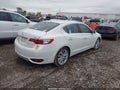 2017 Acura ILX — photo 4 of 16 | VIN 19UDE2F70HA011929