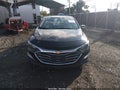 2022 Chevrolet Malibu — photo 12 of 17 | VIN 1G1ZD5ST5NF131521