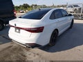 2026 Volkswagen Jetta — photo 4 of 16 | VIN 3VW2M7BU8TM043053