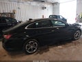 2022 Chevrolet Malibu — photo 4 of 16 | VIN 1G1ZD5ST1NF102419