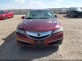 2015 Acura TLX — photo 12 of 17 | VIN 19UUB1F55FA009897