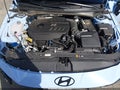2026 Hyundai Elantra — photo 10 of 16 | VIN KMHLW4DK5TU040405