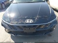 2026 Hyundai Elantra — photo 6 of 16 | VIN KMHLS4DG1TU106522