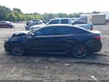 2018 Acura TLX — photo 13 of 15 | VIN 19UUB2F69JA010185