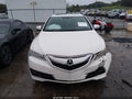 2015 Acura TLX — photo 12 of 16 | VIN 19UUB1F55FA004666