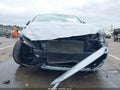 2017 Hyundai Elantra — photo 6 of 17 | VIN 5NPD74LF8HH105971