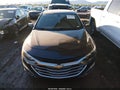 2022 Chevrolet Malibu — photo 11 of 15 | VIN 1G1ZD5ST3NF138306