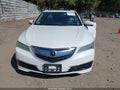 2017 Acura TLX — photo 12 of 16 | VIN 19UUB1F3XHA003109