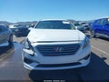 2017 Hyundai Sonata — photo 11 of 15 | VIN 5NPE24AF0HH452359