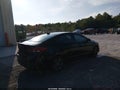 2017 Hyundai Elantra — photo 4 of 21 | VIN 5NPD84LF5HH175327
