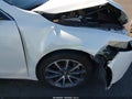 2017 Acura TLX — photo 12 of 20 | VIN 19UUB2F53HA002603