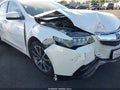 2017 Acura TLX — photo 6 of 20 | VIN 19UUB2F53HA002603