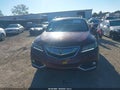 2016 Acura RDX — photo 12 of 21 | VIN 5J8TB4H79GL008110