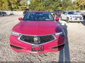 2018 Acura TLX — photo 12 of 18 | VIN 19UUB1F31JA011590