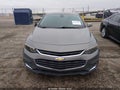 2018 Chevrolet Malibu Limited — photo 12 of 17 | VIN 1G1ZD5ST6JF196291