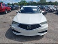 2018 Acura TLX — photo 12 of 16 | VIN 19UUB1F5XJA004963