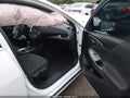 2017 Chevrolet Malibu — photo 5 of 16 | VIN 1G1ZE5ST1HF183570