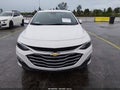 2024 Chevrolet Malibu — photo 6 of 17 | VIN 1G1ZD5ST4RF116255