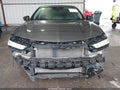 2025 Acura TLX — photo 13 of 17 | VIN 19UUB5F46SA002661