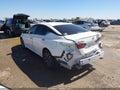 2024 Nissan Altima — photo 3 of 20 | VIN 1N4BL4DV5RN403393