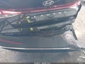 2025 Hyundai Elantra — photo 6 of 16 | VIN KMHLM4DG4SU059169