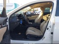 2017 Honda Civic — photo 5 of 18 | VIN 2HGFC2F55HH562209