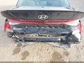 2026 Hyundai Elantra — photo 6 of 16 | VIN KMHLM4DG7TU173636