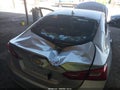 2017 Chevrolet Malibu — photo 6 of 22 | VIN 1G1ZE5ST4HF223740