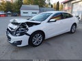 2024 Chevrolet Malibu — photo 2 of 16 | VIN 1G1ZD5ST2RF197949