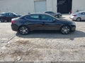 2015 Acura TLX — photo 14 of 17 | VIN 19UUB1F57FA014437