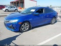 2017 Honda Civic — photo 2 of 16 | VIN 19XFC2F51HE001807
