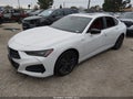 2025 Acura TLX — photo 2 of 18 | VIN 19UUB6F55SA000494